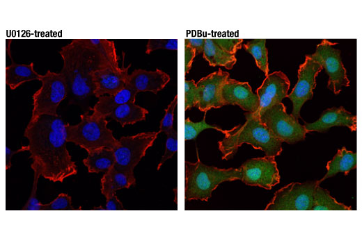 Immunofluorescence Image 2: Phospho-p44/42 MAPK (Erk1/2) (Thr202/Tyr204) (D13.14.4E) XP® Rabbit mAb