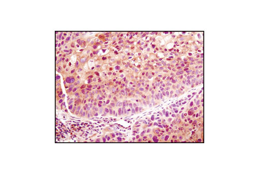 Immunohistochemistry Image 1: LDHA (C4B5) Rabbit mAb (BSA and Azide Free)