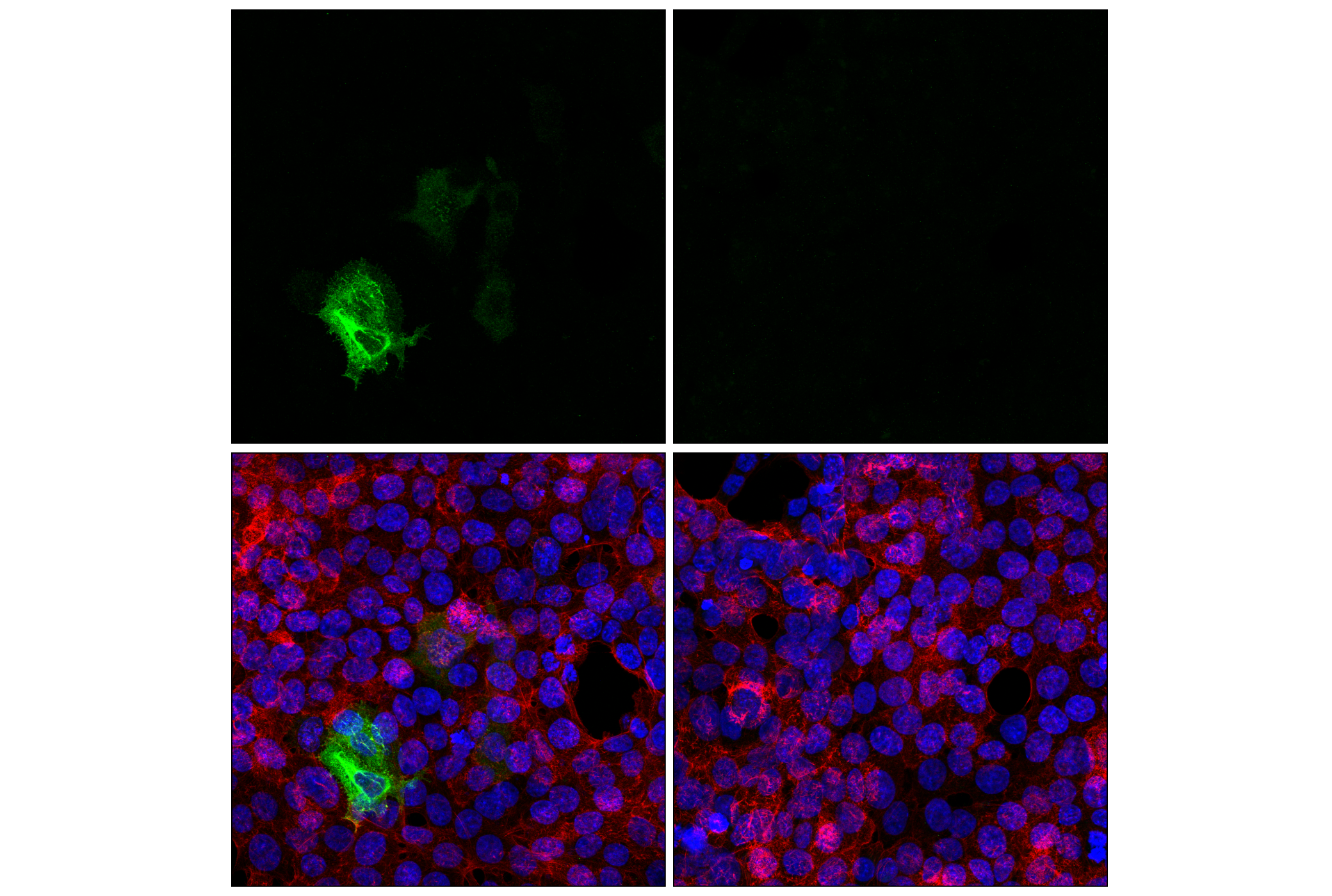 Immunofluorescence Image 1: LshCas13a/C2c2 (Leptotrichia shahii) (7D1-H7) Mouse mAb