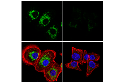 Immunofluorescence Image 1: LACTB (E2V3S) Rabbit mAb