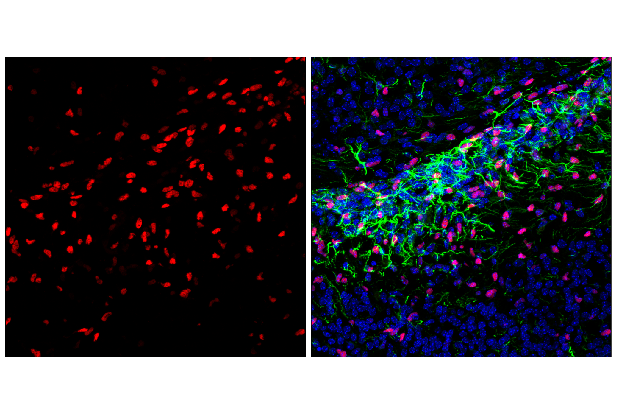 Immunofluorescence Image 1: Olig2 (E6G6Q) XP® Rabbit mAb (Alexa Fluor® 647 Conjugate)