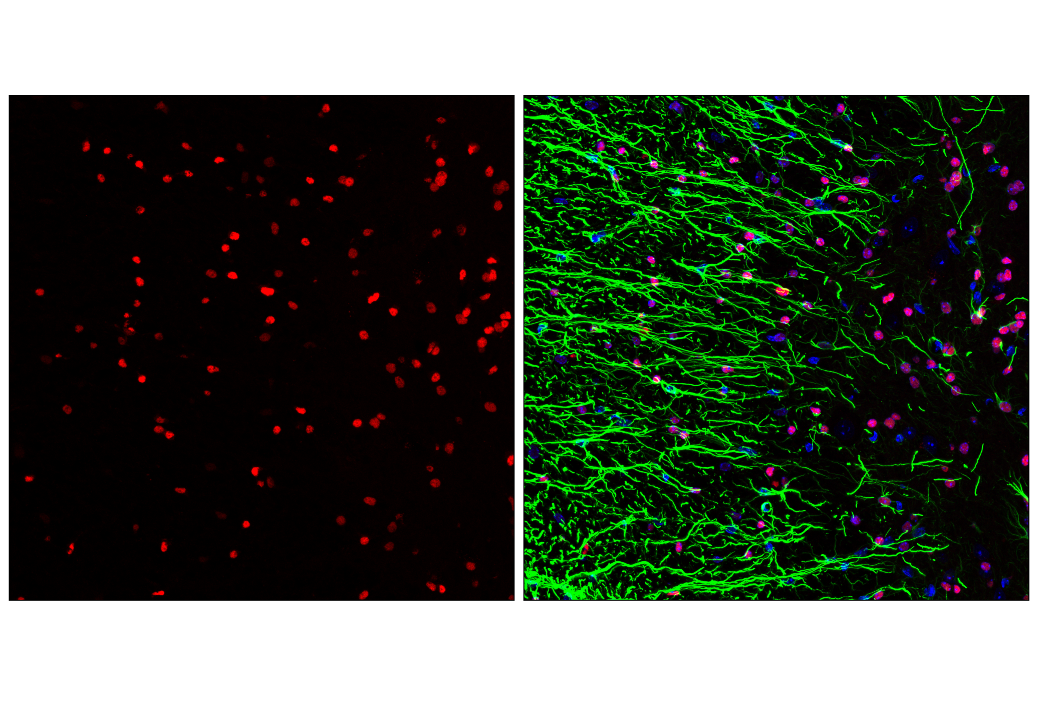 Immunofluorescence Image 2: Olig2 (E6G6Q) XP® Rabbit mAb (Alexa Fluor® 647 Conjugate)