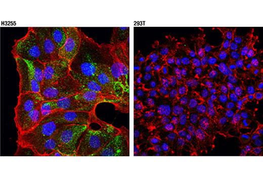 Napsin A (D2G1Y) Rabbit mAb (IF Formulated) | Cell Signaling Technology
