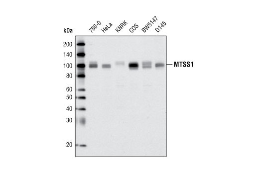 Western Blotting Image 1: MTSS1 (N747) Antibody