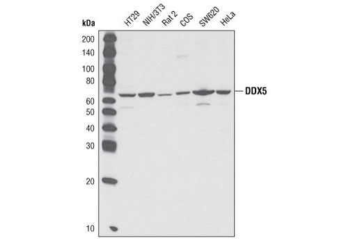 Western Blotting Image 1: DDX5 Antibody
