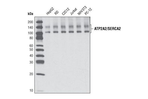 Western Blotting Image 1: ATP2A2/SERCA2 Antibody