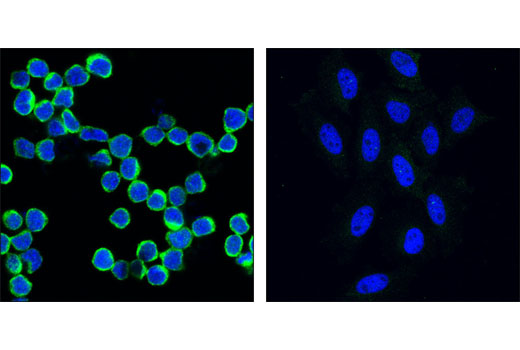 Immunofluorescence Image 1: NFAT1 Antibody