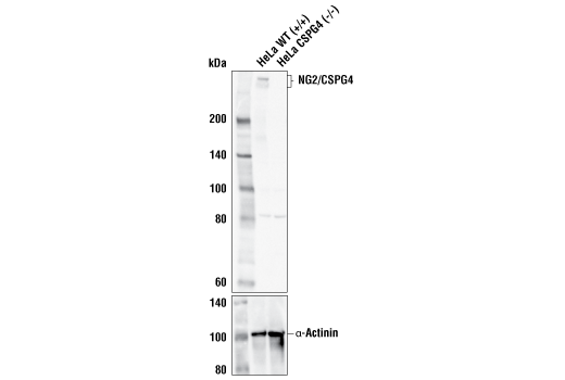  Image 22: Oligodendrocyte Marker Antibody Sampler Kit