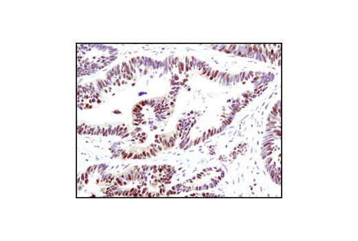 Immunohistochemistry Image 1: Phospho-MAPK Substrates (PXTP) (46G11) Rabbit mAb