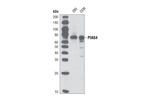  Image 4: Jak/Stat Pathway Inhibitors Antibody Sampler Kit