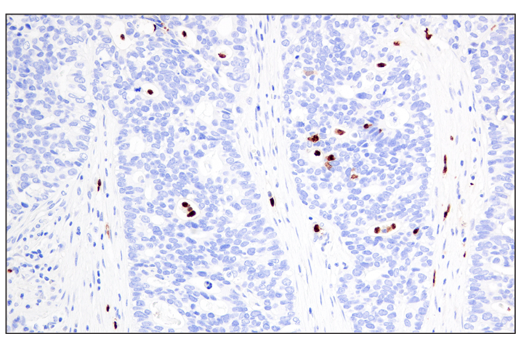 Immunohistochemistry Image 1: Arginase-1 (E4U1I) Mouse mAb