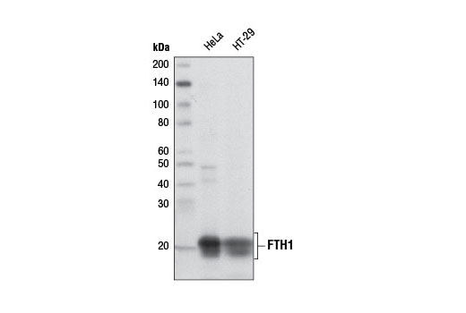  Image 5: Ferroptosis Antibody Sampler Kit