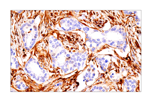 Immunohistochemistry Image 1: FTH1 (D1D4) Rabbit mAb