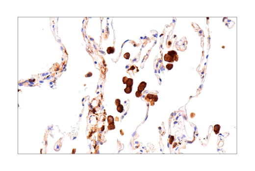 Immunohistochemistry Image 6: FTH1 (D1D4) Rabbit mAb