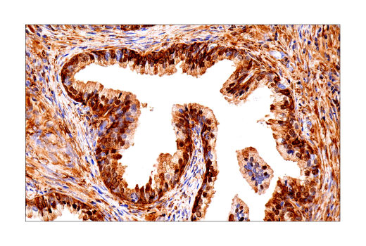 Immunohistochemistry Image 4: FTH1 (D1D4) Rabbit mAb