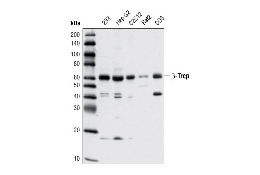 Western Blotting Image 1: β-TrCP (D13F10) Rabbit mAb