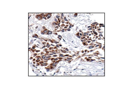 Immunohistochemistry Image 2: NF-κB2 p100/p52 (18D10) Rabbit mAb (BSA and Azide Free)