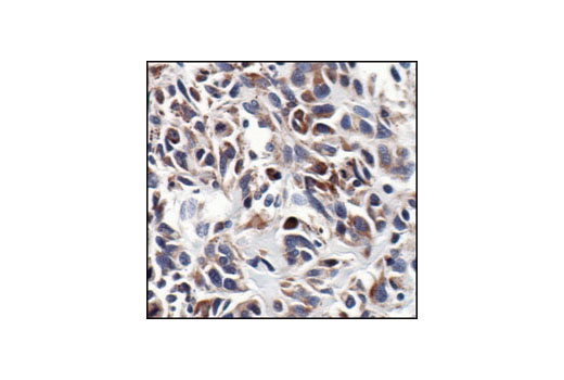Immunohistochemistry Image 4: NF-κB2 p100/p52 (18D10) Rabbit mAb (BSA and Azide Free)
