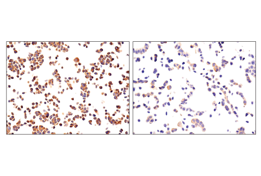 Immunohistochemistry Image 3: NF-κB2 p100/p52 (18D10) Rabbit mAb (BSA and Azide Free)