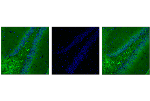Immunofluorescence Image 1: Phospho-Tau (Thr205) (E7D3E) Rabbit mAb (Alexa Fluor® 488 Conjugate)
