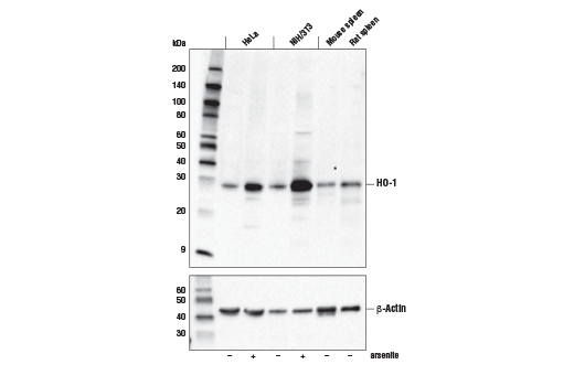 Image 7: p62/KEAP1/NRF2 Pathway Antibody Sampler Kit