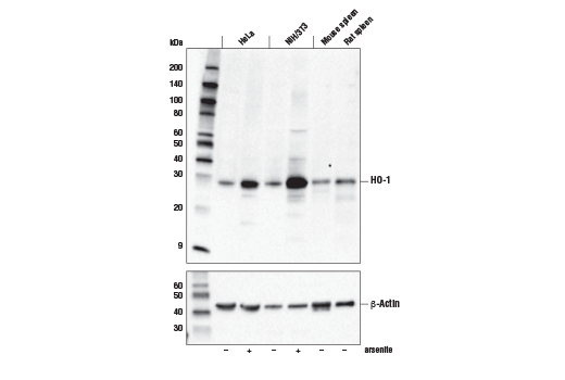 undefined Image 6: p62/KEAP1/NRF2 Pathway Antibody Sampler Kit