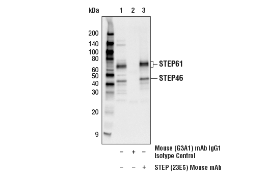 Immunoprecipitation Image 1: STEP (23E5) Mouse mAb