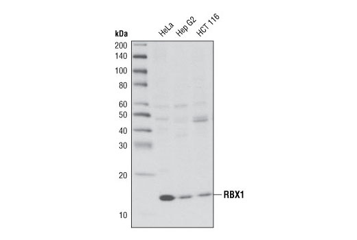 Western Blotting Image 1: RBX1 Antibody