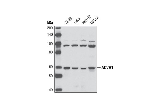 Western Blotting Image 1: ACVR1 Antibody