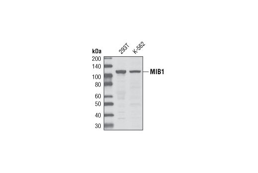 Western Blotting Image 1: MIB1 Antibody