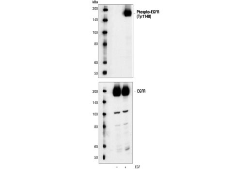 Western Blotting Image 1: Phospho-EGF Receptor (Tyr1148) Antibody