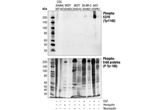 Western Blotting Image 2: Phospho-EGF Receptor (Tyr1148) Antibody