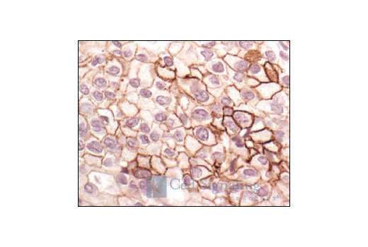 Immunohistochemistry Image 1: Phospho-EGF Receptor (Tyr1148) Antibody