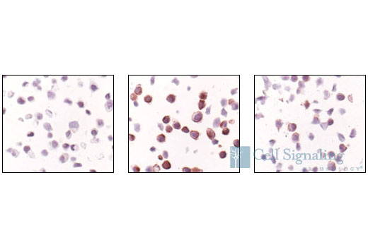Immunohistochemistry Image 2: Phospho-EGF Receptor (Tyr1148) Antibody