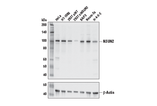 Western Blotting Image 1: NSUN2 Antibody