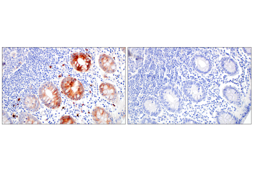 Immunohistochemistry Image 11: LCN2 (D4M8L) Rabbit mAb