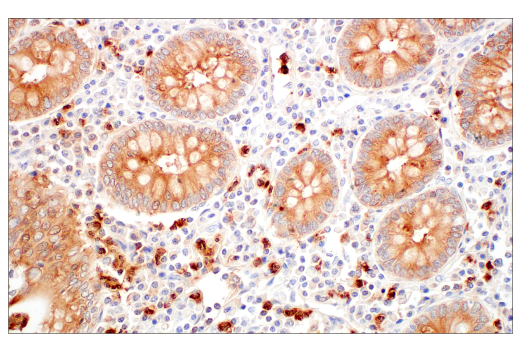 Immunohistochemistry Image 6: LCN2 (D4M8L) Rabbit mAb