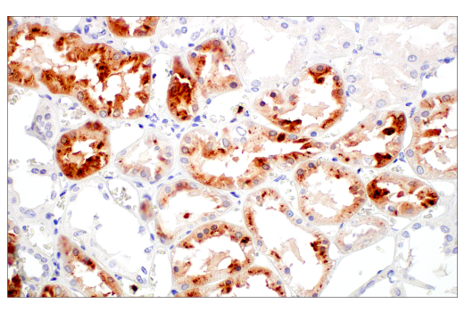 Immunohistochemistry Image 7: LCN2 (D4M8L) Rabbit mAb