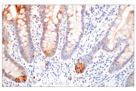 Immunohistochemistry Image 8: LCN2 (D4M8L) Rabbit mAb