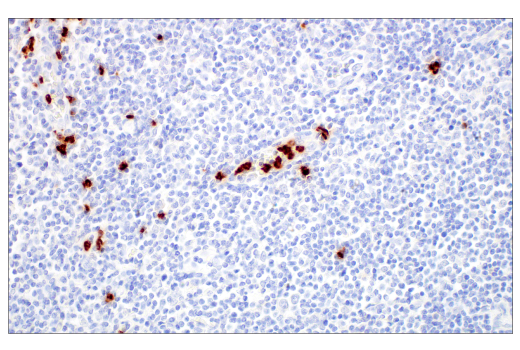 Immunohistochemistry Image 10: LCN2 (D4M8L) Rabbit mAb