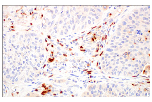 Immunohistochemistry Image 5: LCN2 (D4M8L) Rabbit mAb