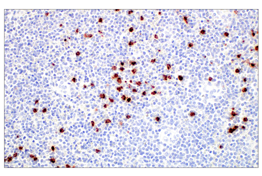 Immunohistochemistry Image 4: LCN2 (D4M8L) Rabbit mAb