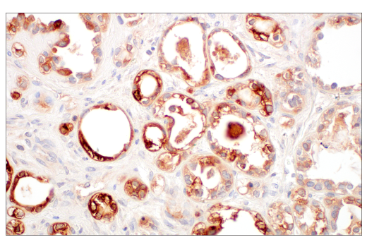Immunohistochemistry Image 3: LCN2 (D4M8L) Rabbit mAb