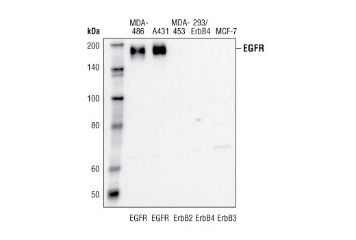 Western Blotting Image 1: EGF Receptor (15F8) Rabbit mAb