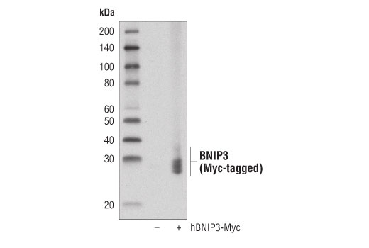  Image 14: Mitophagy Antibody Sampler Kit