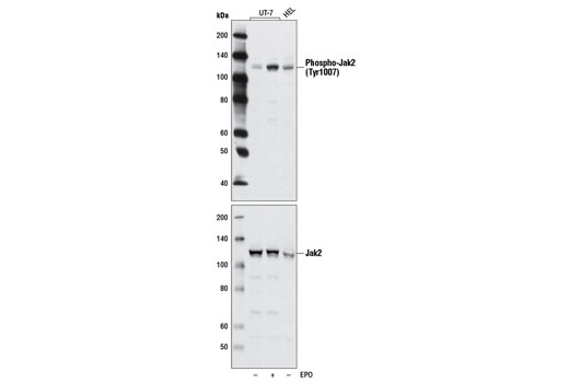 Image 12: ALK Activation Antibody Sampler Kit