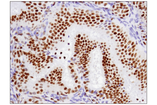 Immunohistochemistry Image 3: ATF-2 (D4L2X) XP® Rabbit mAb (BSA and Azide Free)