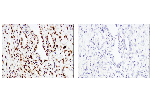 Immunohistochemistry Image 4: ATF-2 (D4L2X) XP® Rabbit mAb (BSA and Azide Free)