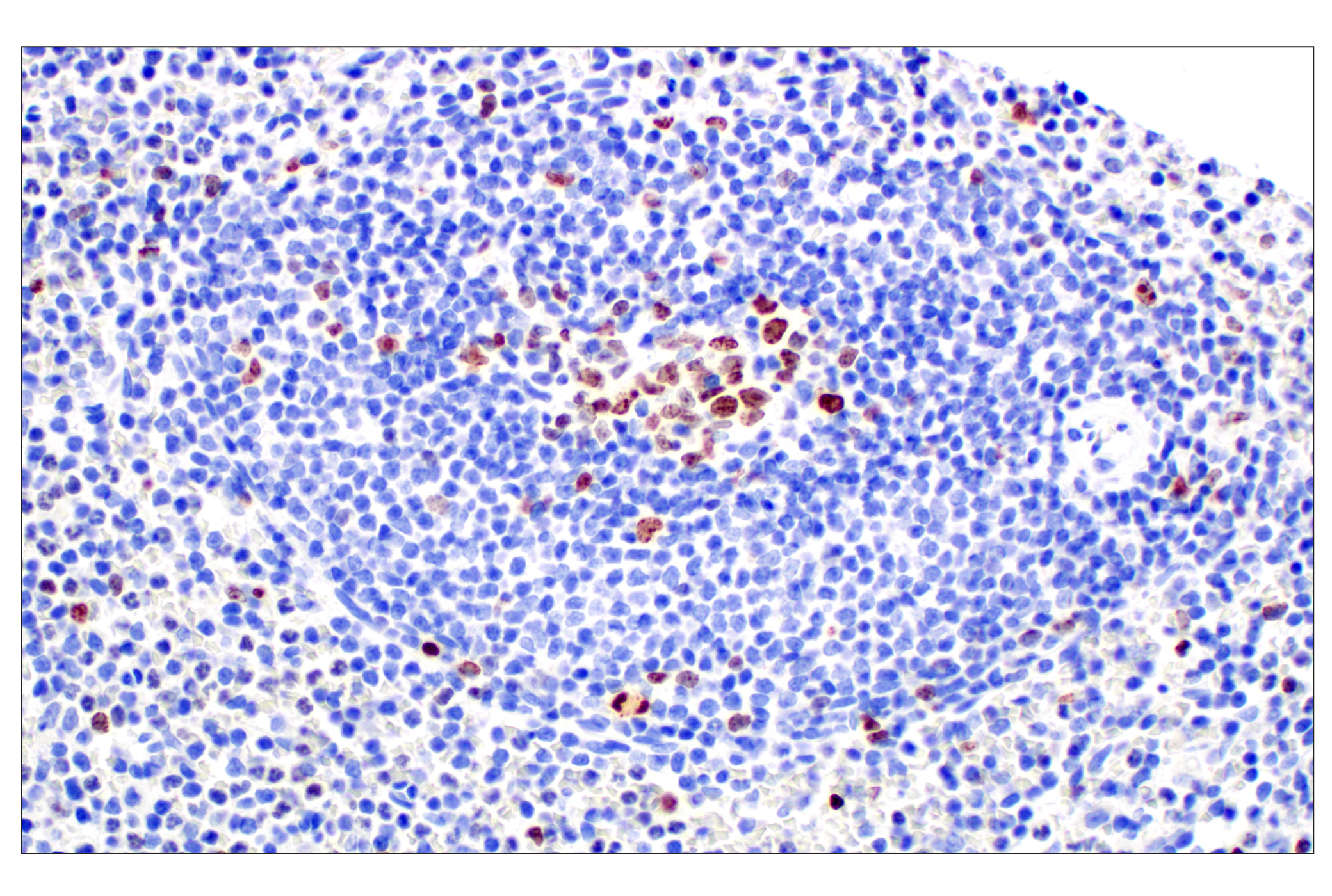 Immunohistochemistry Image 1: Ki-67 (D2H10) Rabbit mAb (BSA and Azide Free)