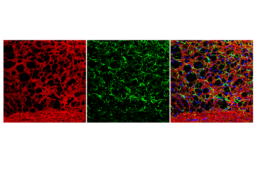 Immunofluorescence Image 1: Anti-mouse IgG (H+L), F(ab')2 Fragment (Alexa Fluor® 555 Conjugate)